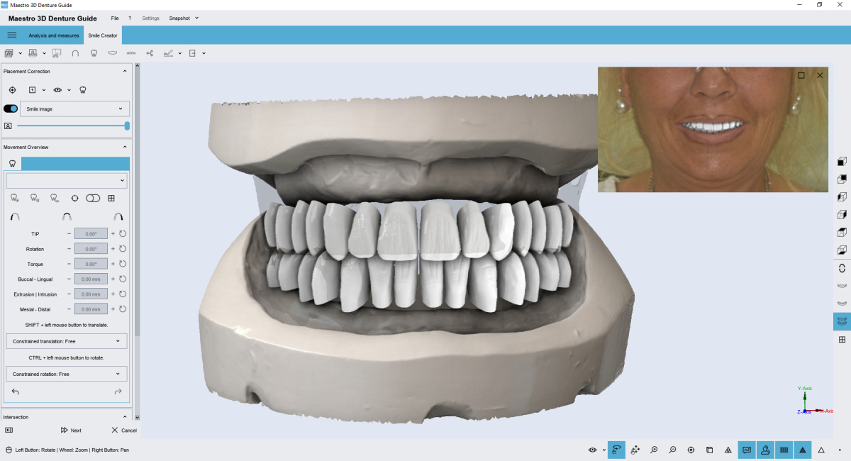 Teeth Positioning