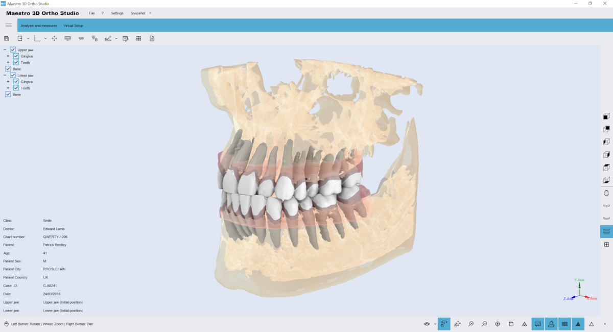 CBCT