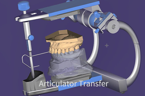 Articulator Transfer